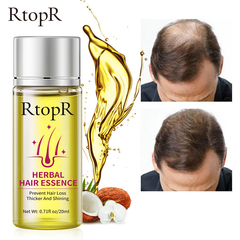 RtopR Herbal Hair Oil for Hair Growth and Nourishment